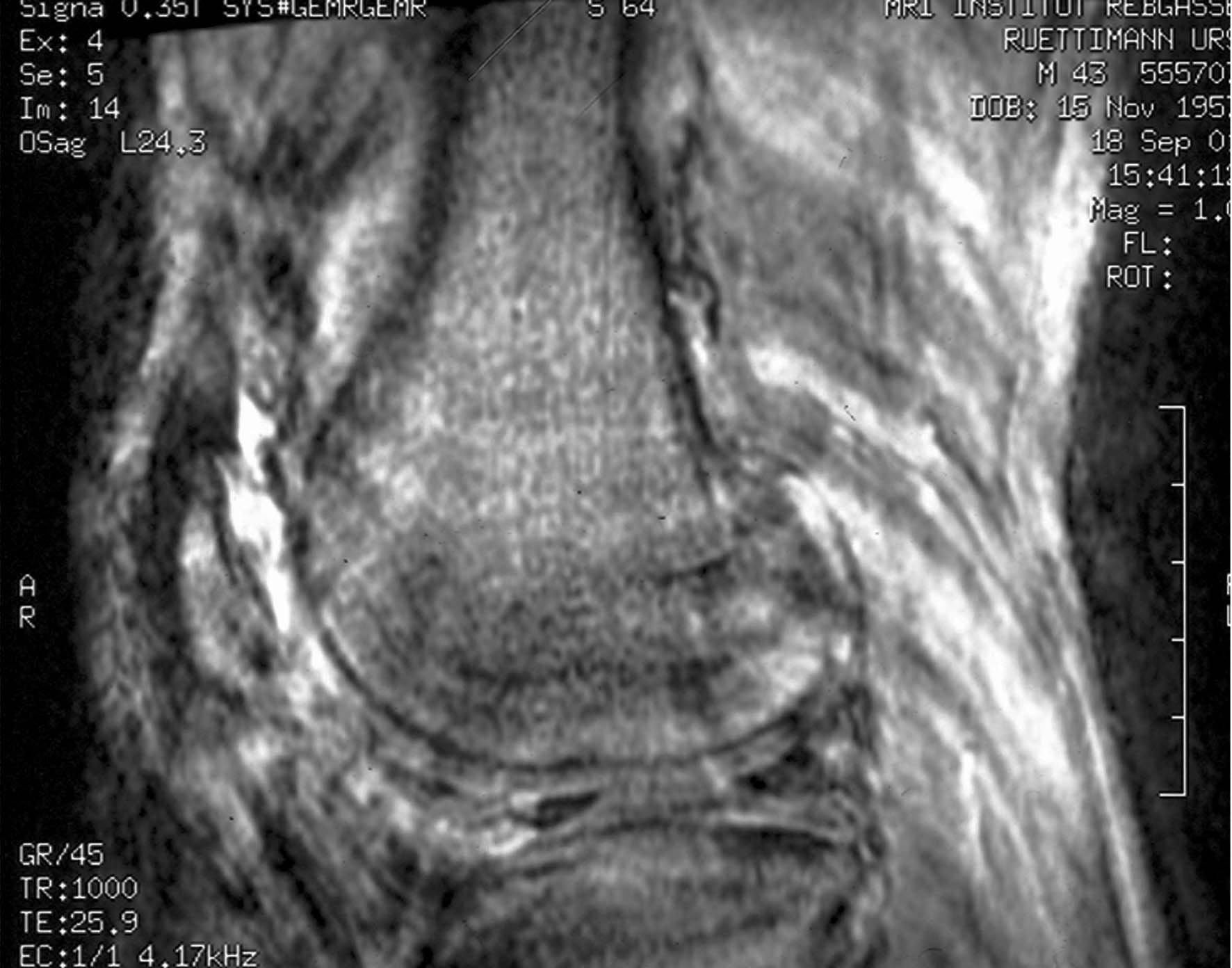 Knee Scan - DIAMAGS OFF