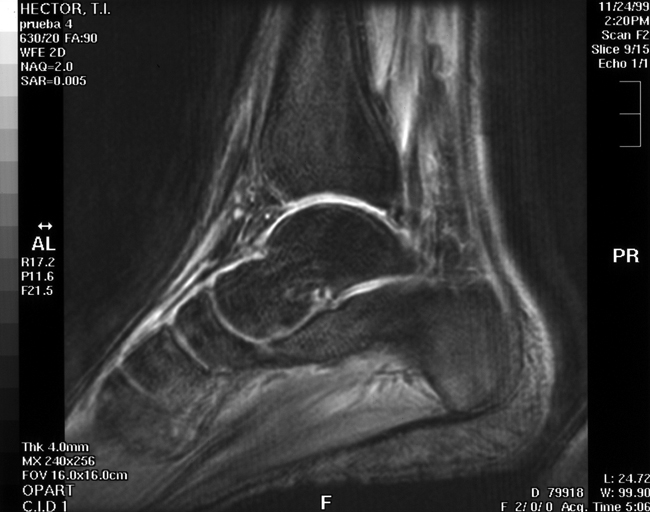 Ankle Scan - DIAMAGS OFF