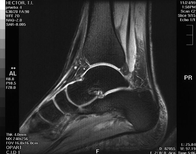 Ankle Scan - DIAMAGS ON