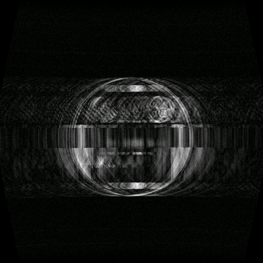 MRI Scan - DIAMAGS OFF