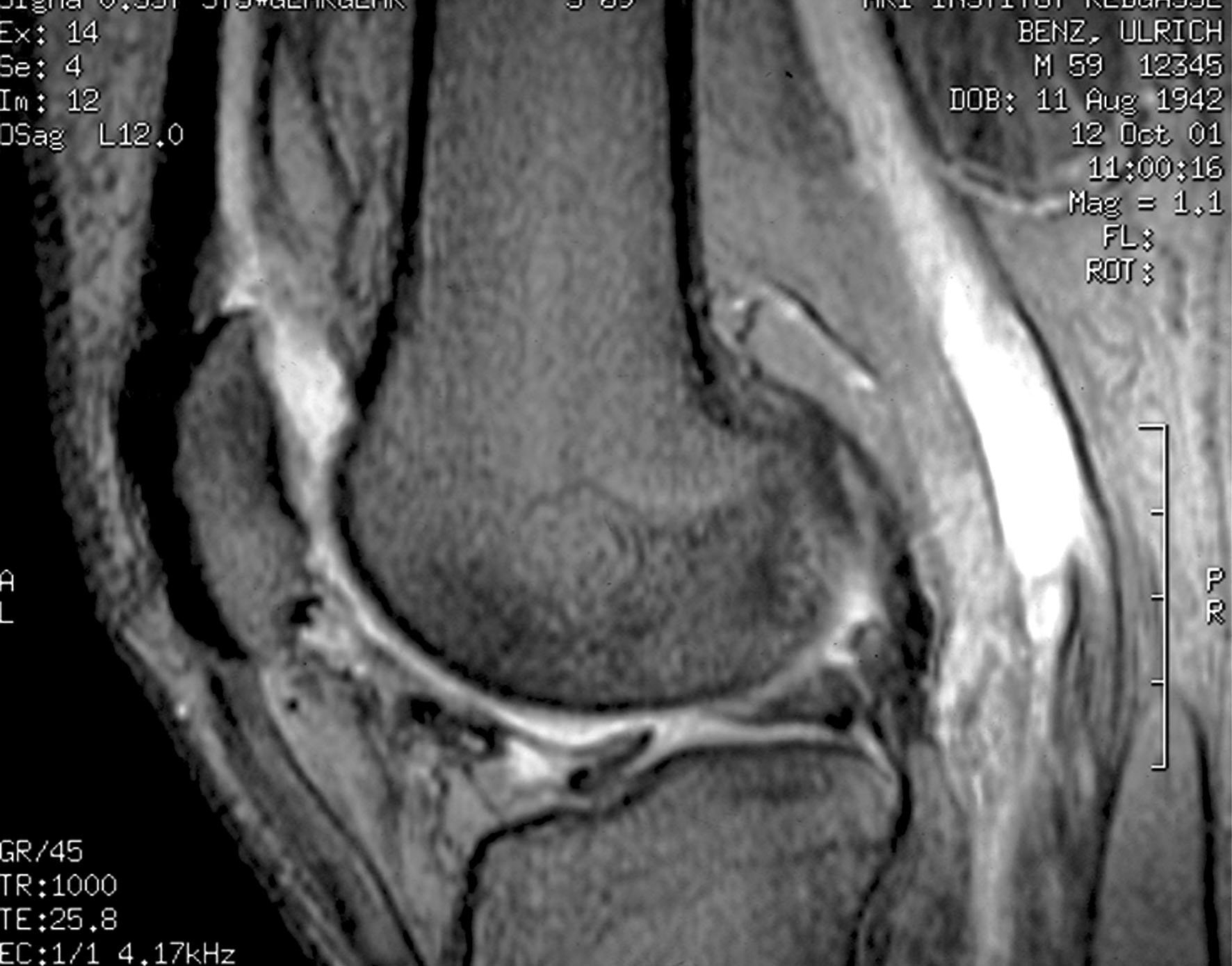 Knee Scan - DIAMAGS ON